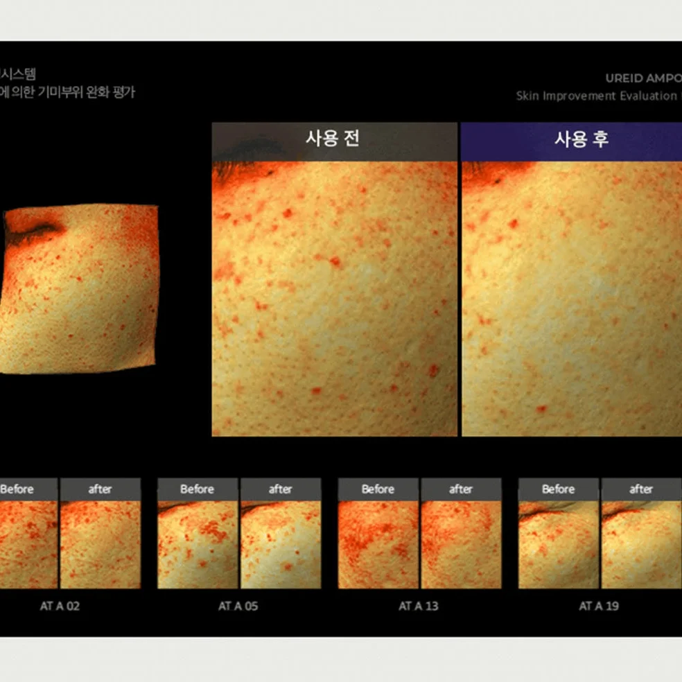 비에논 우레이드 기미앰플 검버섯 흑자 나이아신아마이드 미백앰플 상세 이미지 1