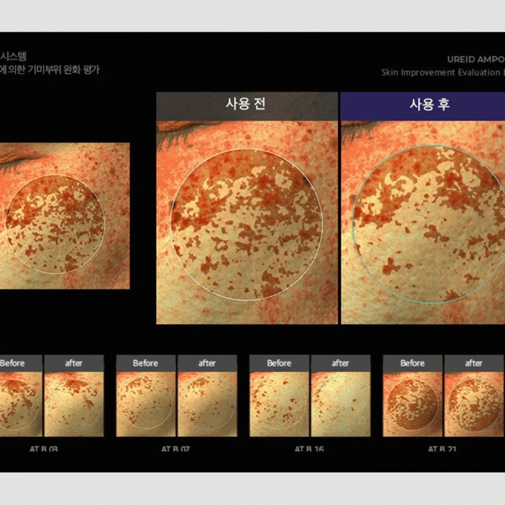 비에논 우레이드 기미앰플 검버섯 흑자 나이아신아마이드 미백앰플 상세 이미지 2