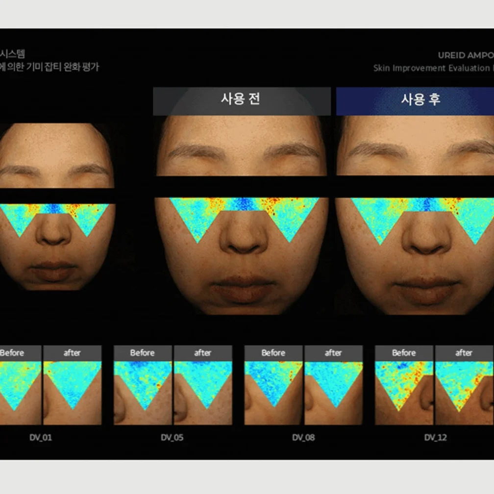 비에논 우레이드 기미앰플 검버섯 흑자 나이아신아마이드 미백앰플 상세 이미지 3